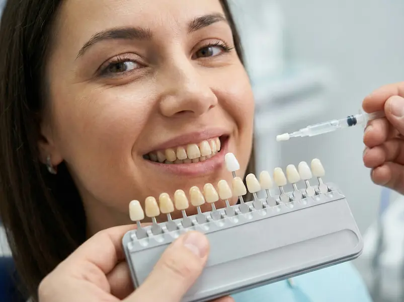 Diş Beyazlatma Sonucu