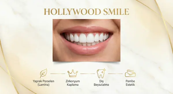 Hollywood Smile Gülüş Tasarımı